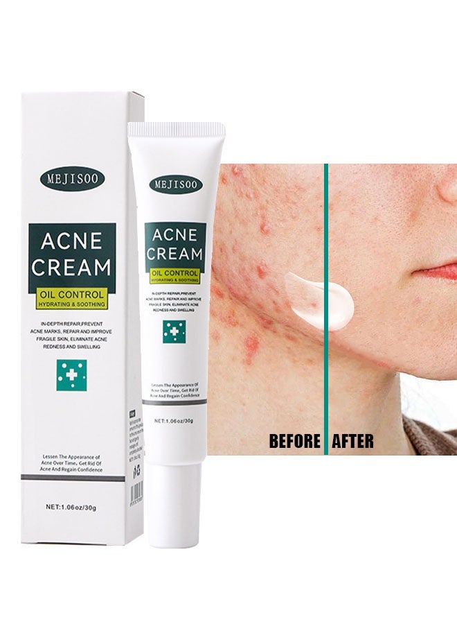MEJISOO Acne Cream,Centella Moisturizer, Acne Cream for Face Natural Ingredients Professionally Remove Acne Marks,Centella Soothing Cream for Anti Acne Oil Control Pimple Lotion for Oily Acne Prone Skin - Image 1